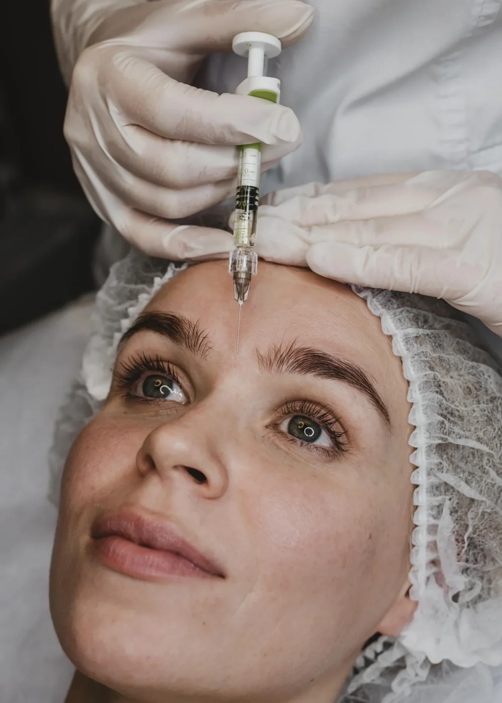 Bioestimuladores de colágeno